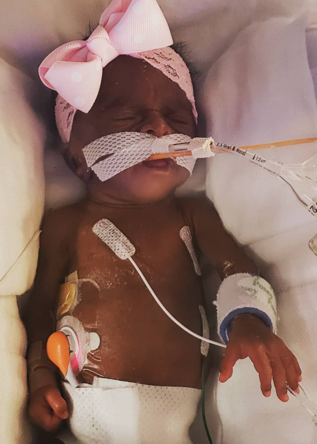 The Simple Nutritional Choice That Could Change Your Preemie’s Future 